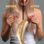 دستگاه فوتون 3نور لیز سوپریم PHOTON SUPREME LIZZE